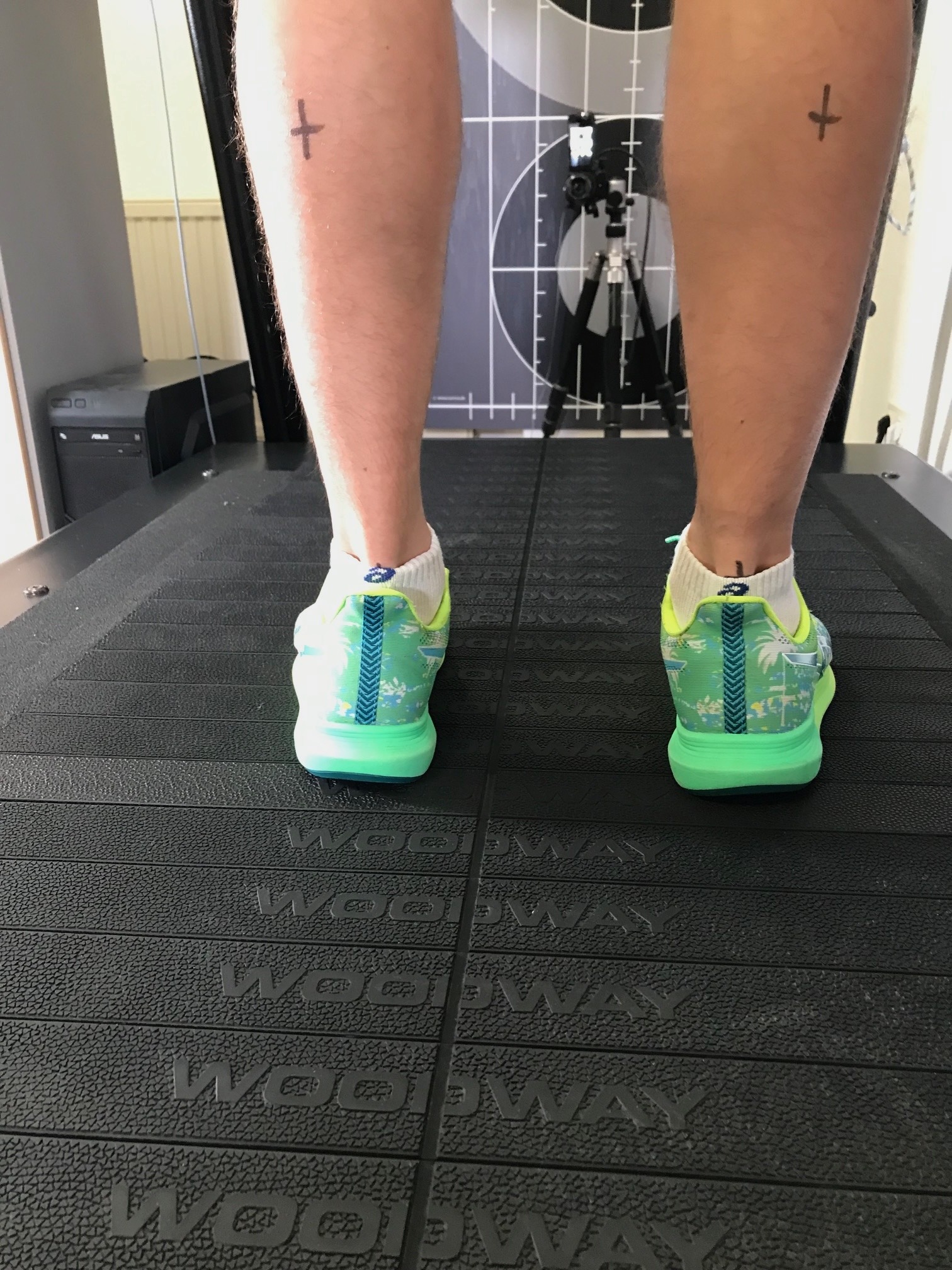 Laufanalyse - Überpronation - Erfahrungsbericht einer Läuferin zur Laufanalyse | SCHORK Sports Freinsheim